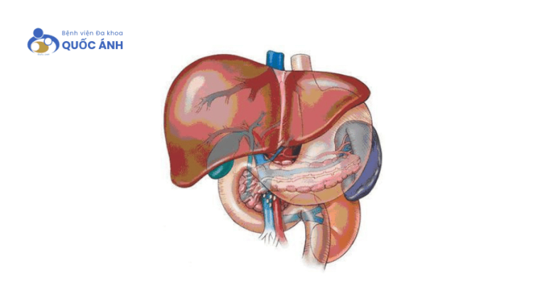 Gan nhiễm mỡ là gì? Nguyên nhân, triệu chứng và cách điều trị hiệu quả